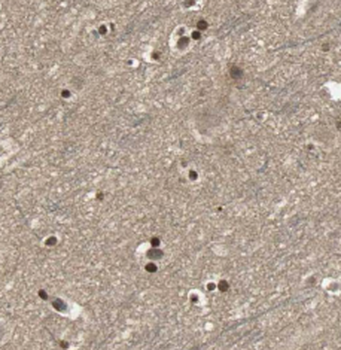 CACNA1C Rabbit Polyclonal Antibody