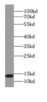 LAMTOR3 Rabbit Polyclonal Antibody