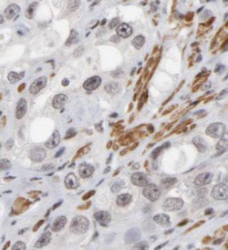 LAMTOR3 Rabbit Polyclonal Antibody