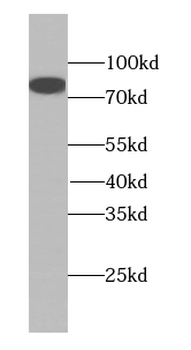 MDM1 Specific Rabbit Polyclonal Antibody
