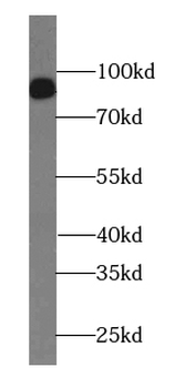 IMMT Rabbit Polyclonal Antibody