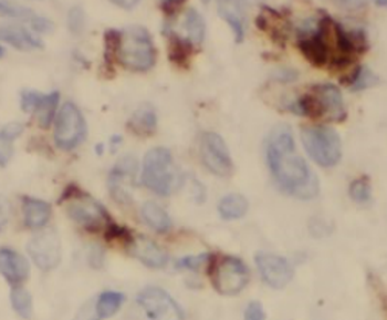 IMMT Rabbit Polyclonal Antibody