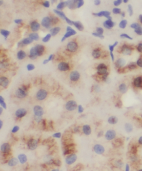 TMEM67 Rabbit Polyclonal Antibody