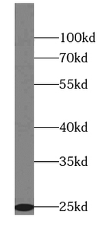 Mtco2 Rabbit Polyclonal Antibody