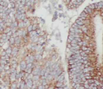 Mtco2 Rabbit Polyclonal Antibody