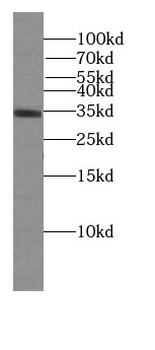 MYCL Rabbit Polyclonal Antibody