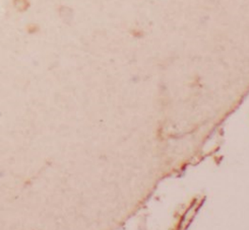 MYH10 Specific Rabbit Polyclonal Antibody