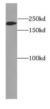 MYH2 specifc Rabbit Polyclonal Antibody