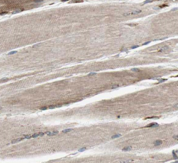 MYH2 specifc Rabbit Polyclonal Antibody