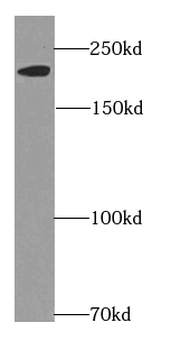 MYH6 Rabbit Polyclonal Antibody