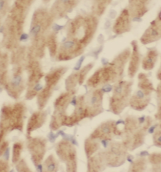 MYH6 Rabbit Polyclonal Antibody