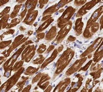 MYH7 specific Rabbit Polyclonal Antibody