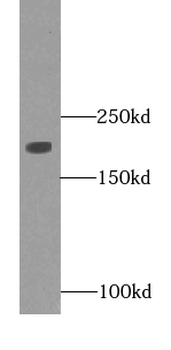 MYH2 Mouse Monoclonal Antibody