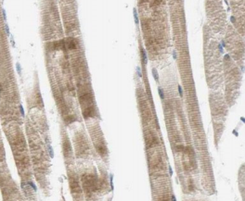 MYH2 Mouse Monoclonal Antibody