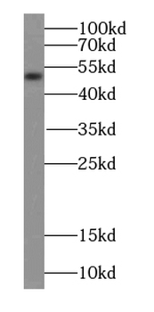 TACR1 Rabbit Polyclonal Antibody