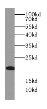 NRTN Specific Rabbit Polyclonal Antibody
