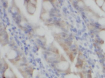 NRTN Specific Rabbit Polyclonal Antibody