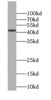 ILF2 Rabbit Polyclonal Antibody