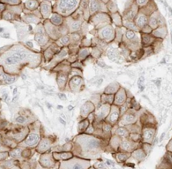 ILF2 Rabbit Polyclonal Antibody
