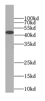 ILF2 Rabbit Polyclonal Antibody