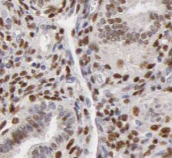 ILF2 Rabbit Polyclonal Antibody