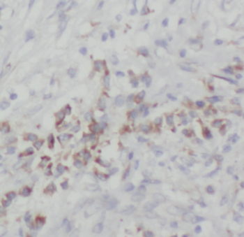 NOB1 Mouse Monoclonal Antibody