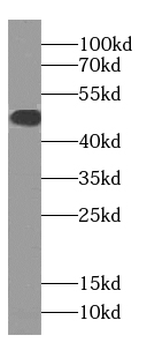 SLC22A16 Specific Rabbit Polyclonal Antibody