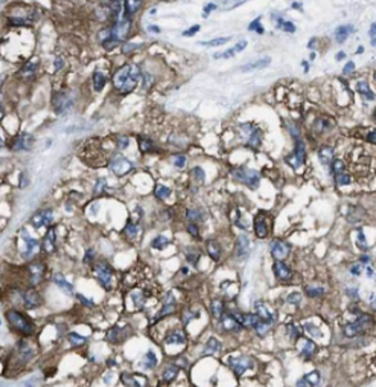 OPTN Mouse Monoclonal Antibody