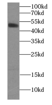 HCRTR1 Rabbit Polyclonal Antibody