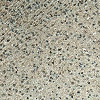 HCRTR1 Rabbit Polyclonal Antibody
