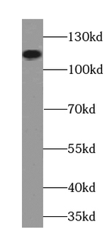 BCAR1 Rabbit Polyclonal Antibody