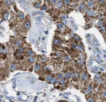 BCAR1 Rabbit Polyclonal Antibody