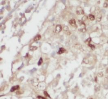 MAPK14 Mouse Monoclonal Antibody