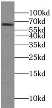 PLA2G7 Rabbit Polyclonal Antibody