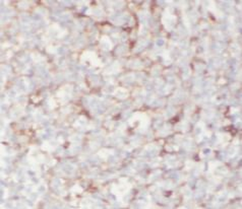 PLA2G7 Rabbit Polyclonal Antibody
