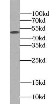 PARP15 Rabbit Polyclonal Antibody