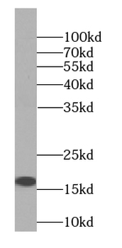 PSPN Specific Rabbit Polyclonal Antibody