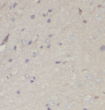 PSPN Specific Rabbit Polyclonal Antibody