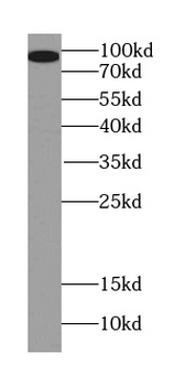 PGAP1 Rabbit Polyclonal Antibody