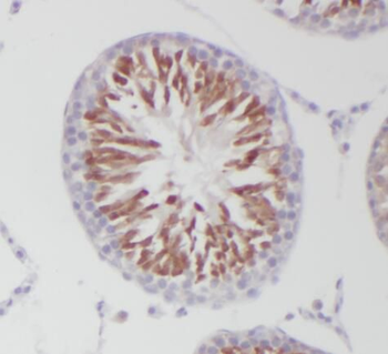 PGAP1 Rabbit Polyclonal Antibody