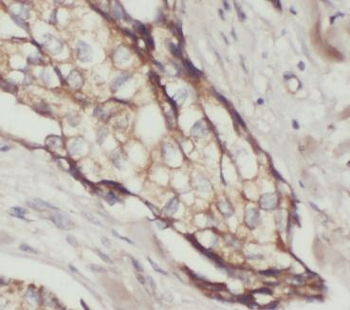 Phospho Akt (Ser473) Mouse Monoclonal Antibody