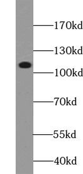 PIK3CA Rabbit Polyclonal Antibody