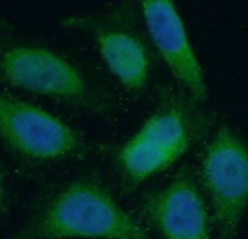 PIK3R1 Mouse Monoclonal Antibody