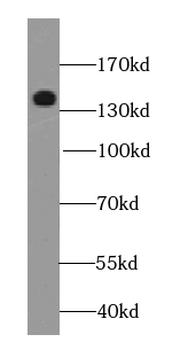 POLR2B Specific Rabbit Polyclonal Antibody