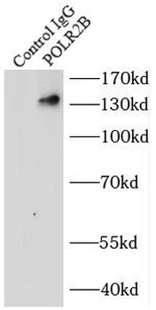 POLR2B Specific Rabbit Polyclonal Antibody
