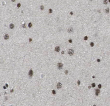 POLR2B Specific Rabbit Polyclonal Antibody