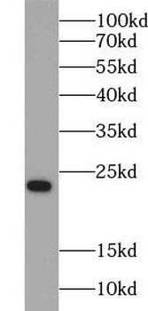 Pre IL18 Rabbit Polyclonal Antibody