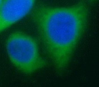 Pre IL18 Rabbit Polyclonal Antibody