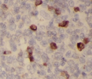 Pre IL18 Rabbit Polyclonal Antibody