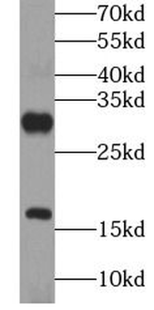 GRP Rabbit Polyclonal Antibody